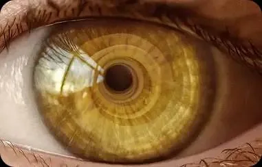 EMDR for Anxiety in Los Angeles