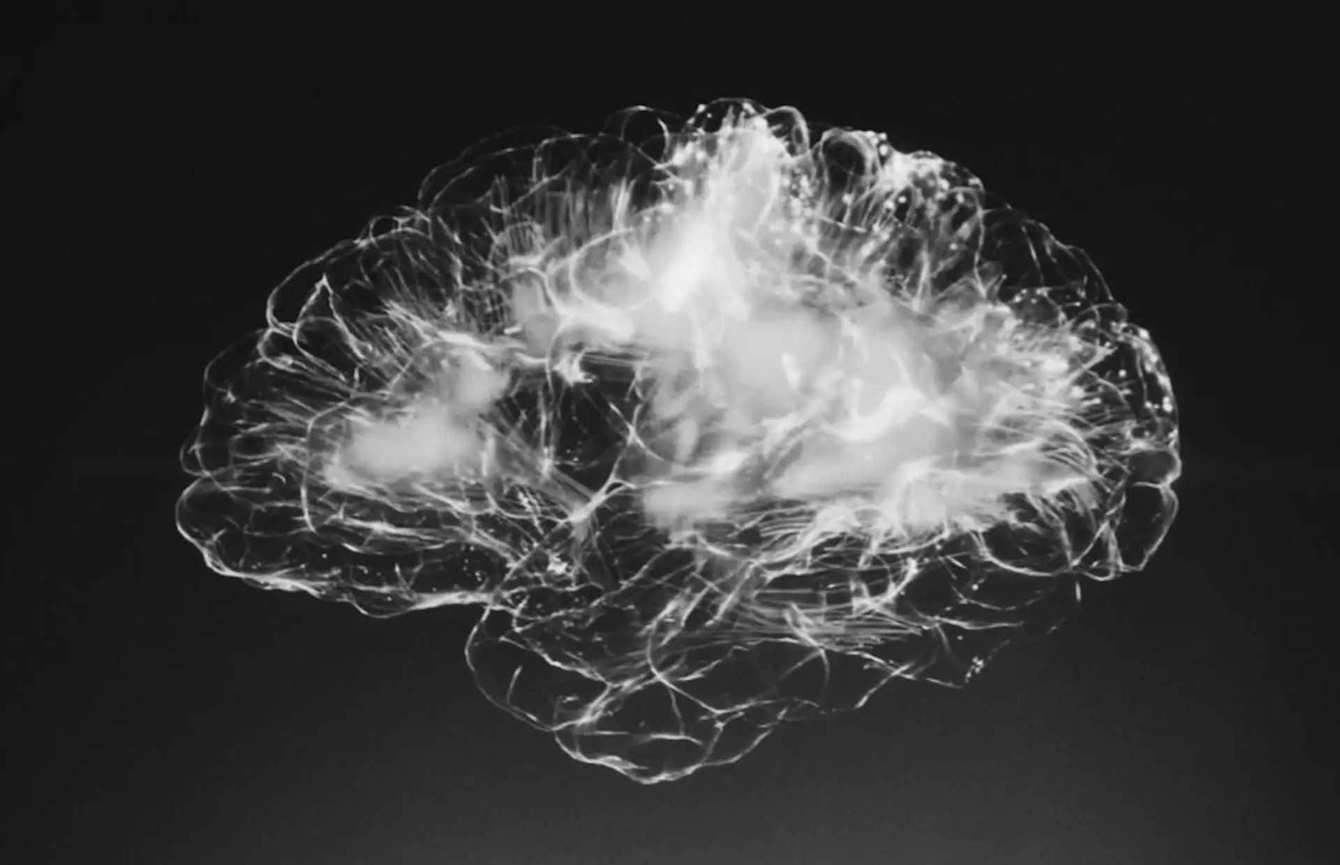 neurofeedback